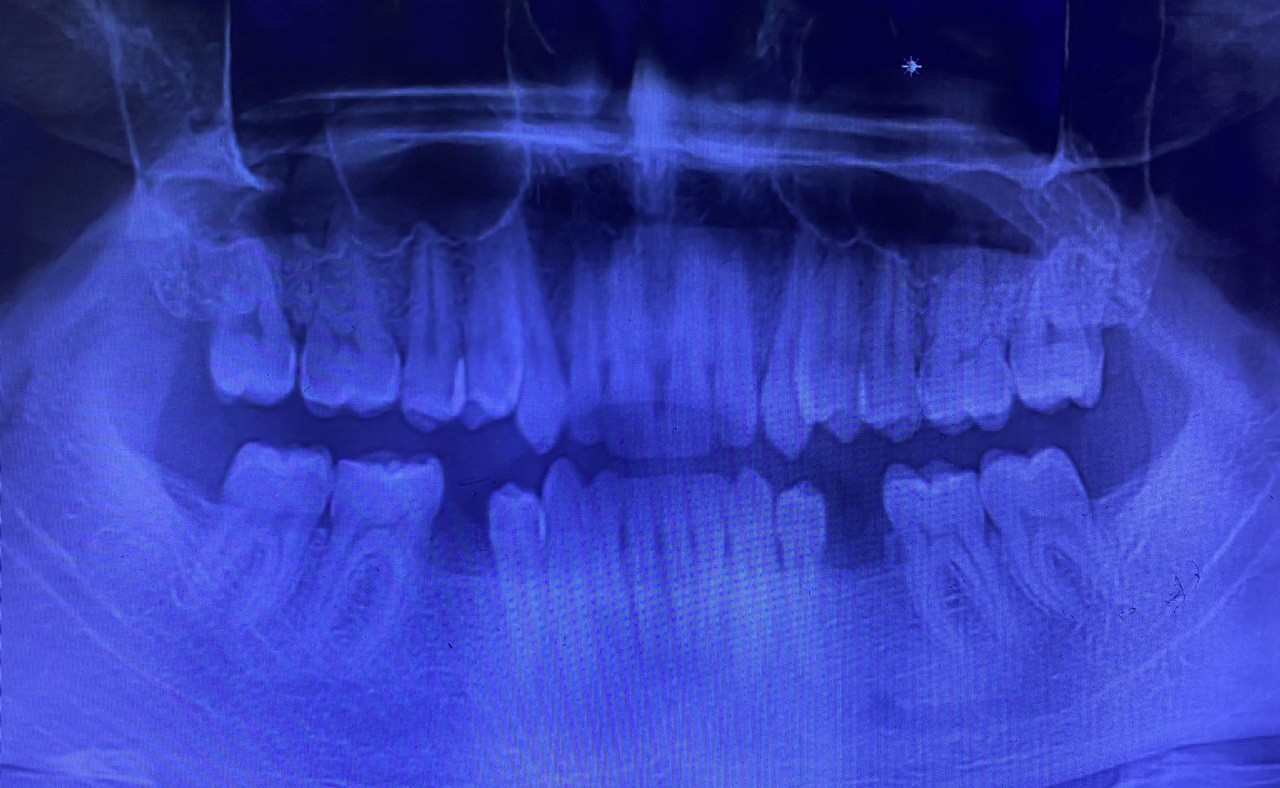 Oral Diagnoz ve Radyoloji</h4>